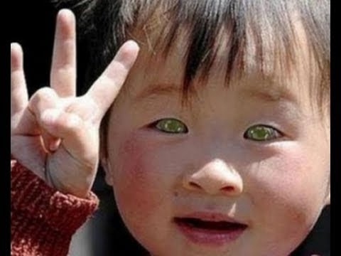 STAR CHILD BORN IN CHINA - EYES THAT SEE IN DARKNESS