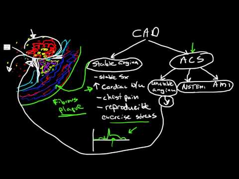 Pathophysiology of Coronary Artery Disease