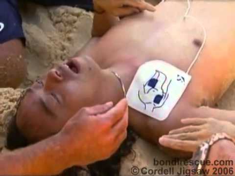 Agonal Gasps - Bondi Beach Rescue