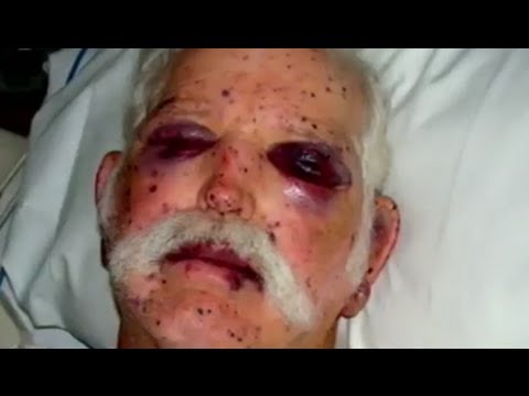 Attacked By 2000 Bees - Bizarre ER