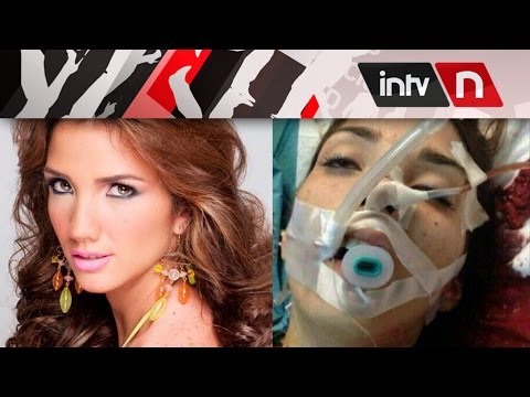 MUERE GENESIS CARMONA, MISS TURISMO CARABOBO (VENEZUELA)