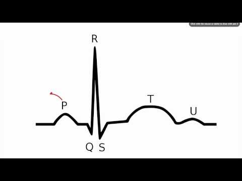 048 How to Read an Electrocardiogram (ECG/EKG)