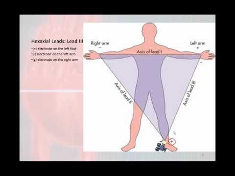 12 Lead Interpretation Part 1: Introduction to the 12 Lead EKG