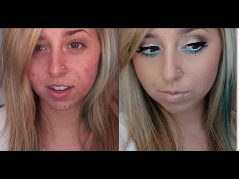 Acne Coverage Foundation Routine