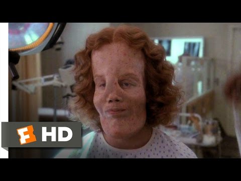 Mask (2/10) Movie CLIP - Rocky's Lionitis (1985) HD