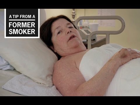 CDC: Tips from Former Smokers - Suzy's Ad