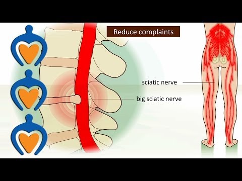 Lower back pain (a.o. sciatica, herniated disk) - It's causes, symptoms and treatment.