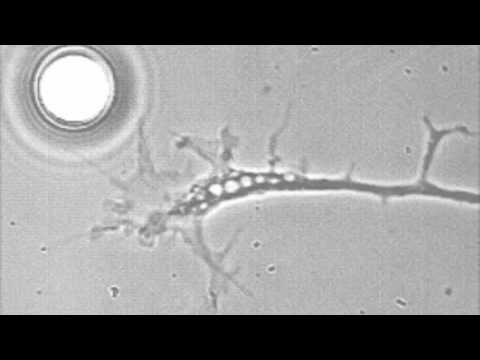 Growth cone guidance by an attractive surface (NGF).mov