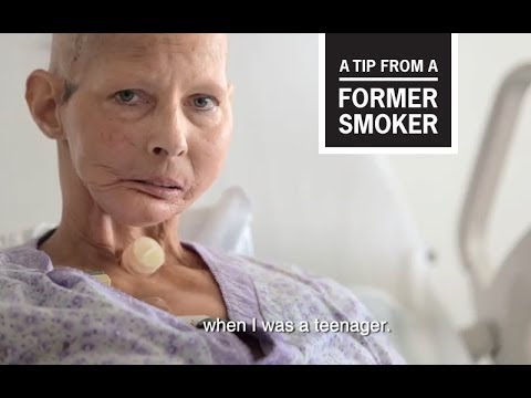 CDC Tips From Former Smokers -- Terrie's Ad: Teenage Regrets