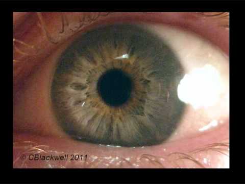 Eye Works 1: Focusing: Cornea, Iris and Lens