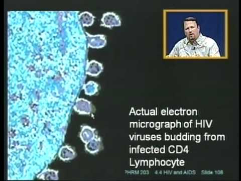 4.4 HIV AIDS