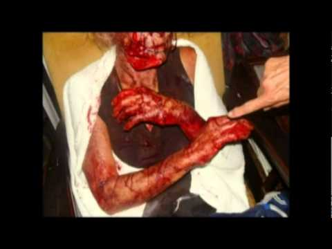 White Farmer Attacks in South Africa