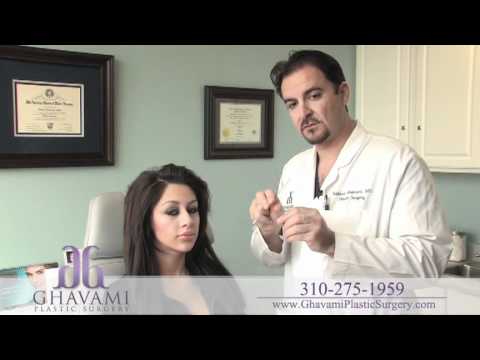 Custom Ethnic(hispanic) Rhinoplasty By Dr Ghavami