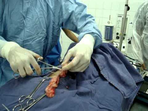 Cirurgia osh em aula pratica 7 minutinhos rapido demais