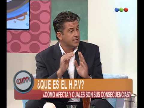 ¿Que es el H.P.V? - AM