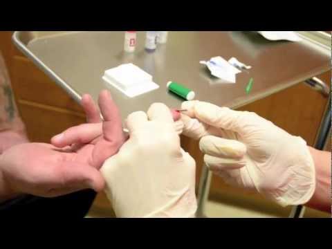 Rapid HIV blood test (HD)