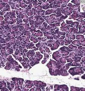 Shotgun Histology Pancreas