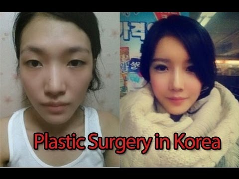 Why Koreans Get So Much Plastic Surgery