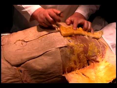 Human Anatomy Dissection 01 Superficial Thorax And Abdomen