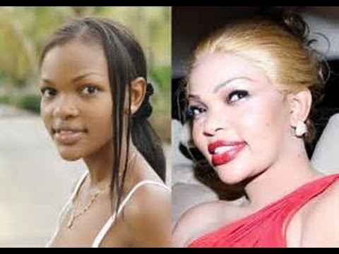 SKIN BLEACHING ADDICTION