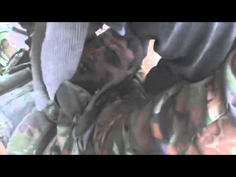 FNN Syria Amjad Al Islam Brigade one of the brigade's fighters injured  WARNING GRAPHIC+21