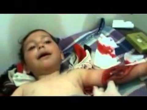 Bébé blessé par un sniper de tir explosif Talbisa Homs.flv