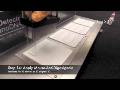 Bio SB Chromogenic In-Situ Hybridization (CISH) Demo (v1)