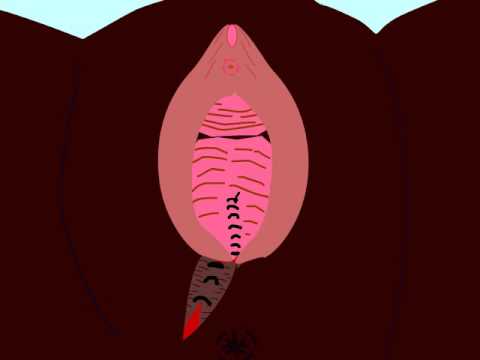 Episiotomy  Repair: Animation of the closure procedure