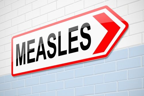 measles