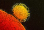 This file photo provided by the National Institute for Allergy and Infectious Diseases shows a colorized transmission of the MERS coronavirus that emerged in 2012.