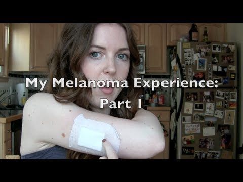 VLOG: Skin Cancer at 23? My Experience with Melanoma: Part 1 | chelsea wears