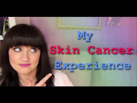 MY SKIN CANCER EXPERIENCE