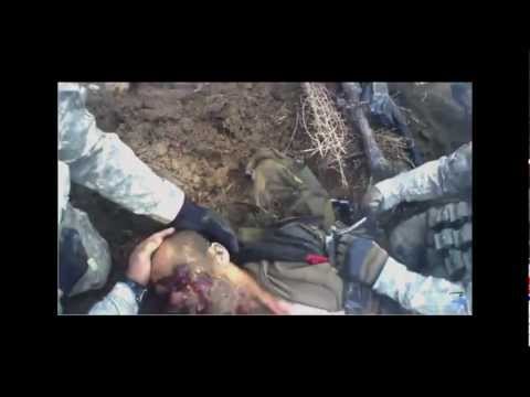 ISAF soldier steps on landmine - **WARNING GRAPHIC MEDICAL PROCEDURES**