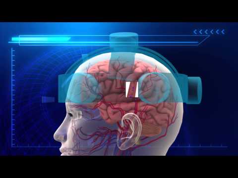 Depression treatment: Electromagnetic helmet breakthrough developed in Denmark