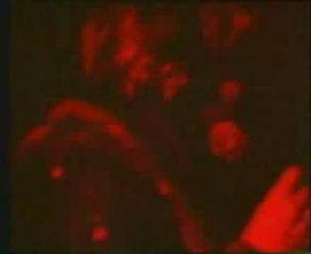 Teardrop Explodes - Treason