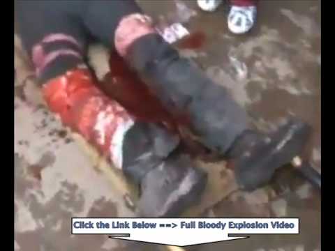 [UNCENSORED BLOODY VIDEO]Terrorism suspected in deadly Belarus subway blast