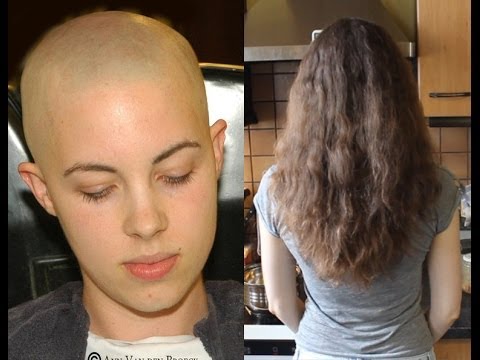 Hair from Bald to Long - Almost 3 years of Hairgrowth