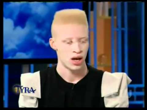 Albino Models on Tyra show