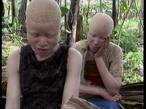 Deadly Hunt: Albinos in Tanzania