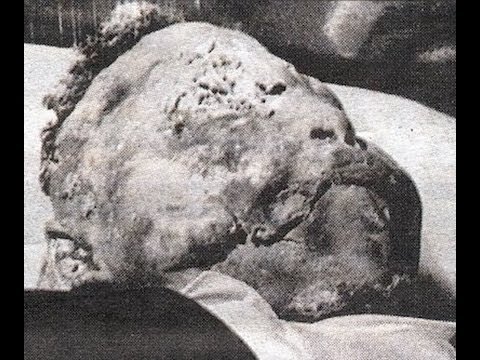 Why Was Emmett Till Murdered? Biography, Case, Civil Rights, Death, Funeral, History, Trial