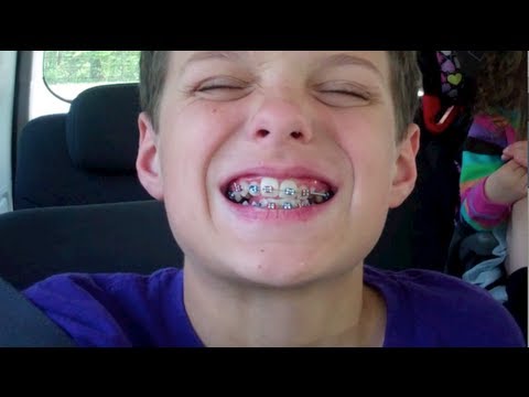 Caleb Gets Braces (WK 121.3)