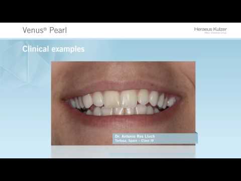 Venus Pearl® - Discover clinical cases and the beauty beyond aesthetics. [EN]