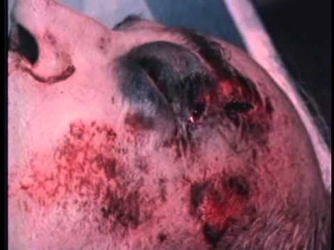 Autopsy Documentary - Crime Scene Autopsy - Autopsy Examination Part II