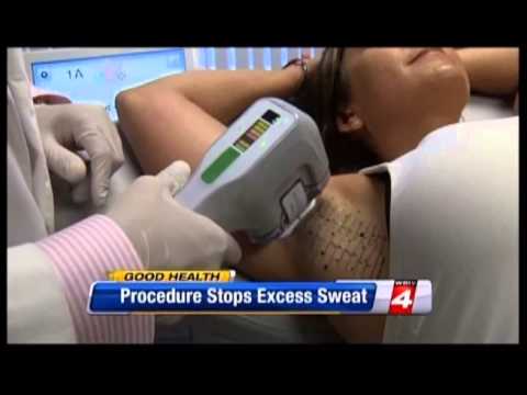 NBC News Miradry for Sweating in Metro Detroit, Michigan