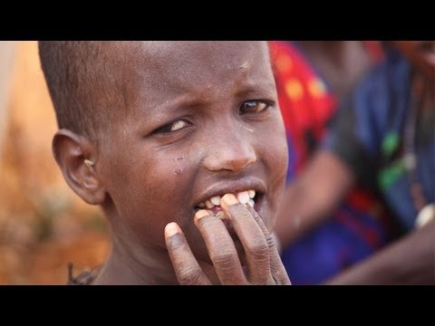 Eyewitness to the Famine - World Concern Saves Lives