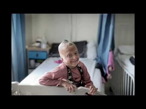 MSF: The Reach of War: Amman