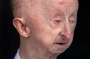 Disabled pensioner Alan Barnes broke his collarbone when he was pushed to the ground by a mugger outside his home.