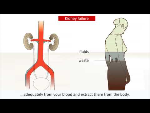 Kidney disease - Causes and treatment of kidney failure