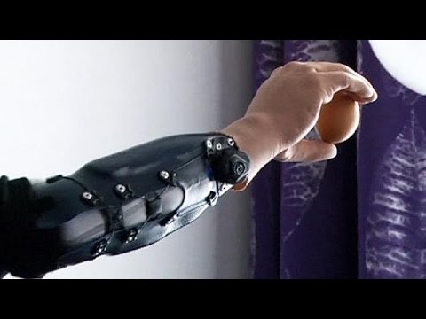 Austrian men become first in the world to have bionic hands