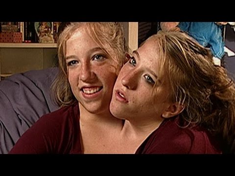 The Twins Who Share A Body - Documentary